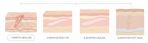 مدت زمان اثر بخشی پماد جای زخم
