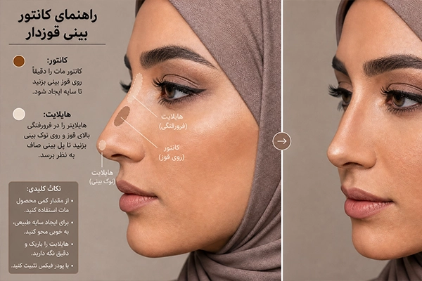 کنتور بینی برای بینی قوز دار
